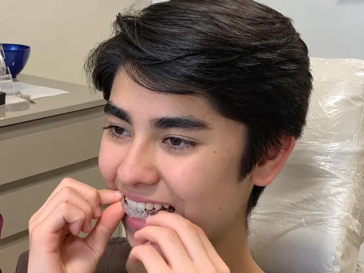 Adolescente colocando o alinhador transparente